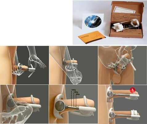 Увеличение полового члена с помощью экстендера